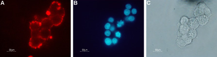 Expression of nAChR β2 in rat PC12 cells