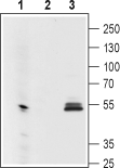 Western blot analysis using Mouse Anti-GIRK1 (Kir3.1) (extracellular) Antibody (#ALM-031), (1:200):