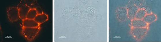 Expression of Kir3.1 in live intact human MCF-7 breast adenocarcinoma cell line