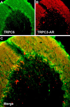 Multiplex staining of TRPC6 and TRPC3 in rat cerebellum