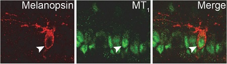 Anti-Melatonin Receptor 1A (MTNR1A) Antibody