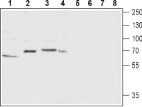 Western blot analysis of rat ovary (lanes 1 and 5), rat brain (lanes 2 and 6), mouse brain membrane (lanes 3 and 7) and human SH-SY5Y brain neuroblastoma  (lanes 4 and 8) lysate: