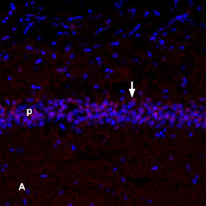 NGF localization in mouse hippocampus.