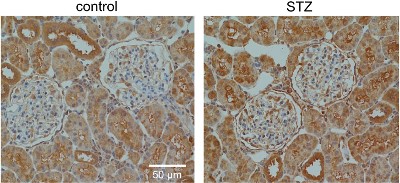 Anti-TRPC6 (extracellular) Antibody