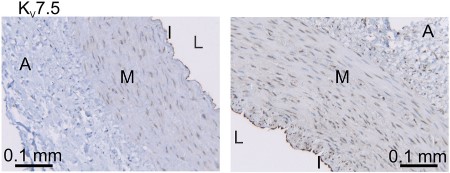 Anti-KCNQ5 Antibody