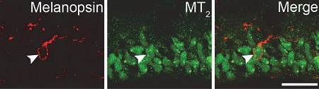 Anti-Melatonin Receptor 1B (MTNR1B) Antibody