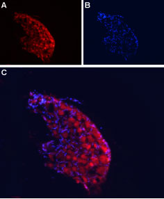Expression of CaVα2δ4 in rat DRG