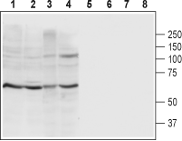 Western blot analysis of rat brain membrane (lanes 1 and 5), mouse brain membrane (lanes 2 and 6), C6 rat brain glioma cell line lysate (lanes 3 and 7) and SH-SY5Y human brain neuroblastoma cell line lysate (lanes 4 and 8):