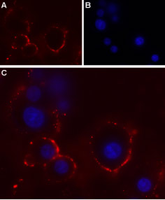 Expression of P2RX4 in rat pheochromocytoma cell line (PC12)