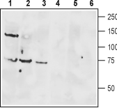 Western blot analysis of rat brain lysate (lanes 1 and 4), mouse brain membranes (lanes 2 and 5) and human Jurkat T cell leukemia cell lysate (lanes 3 and 6):
