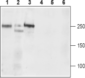 Western blot analysis of rat brain (lanes 1 and 4), mouse brain (lanes 2 and 5), and rat C6  brain Glioma (lanes 3 and 6) lysates: