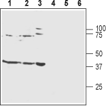 Western blot analysis of rat brain membranes (lanes 1 and 4), mouse brain membranes (lanes 2 and 5) and human SH-SY5Y neuroblastoma cell lysates (lanes 3 and 6):