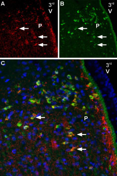 Multiplex staining of Melatonin receptor type 1B and NaV1.2 in rat paraventricular nucleus
