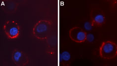 Expression of CaVα2δ4 in rat PC-12 cells