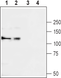 Western blot analysis of rat brain (lanes 1 and 3) and human K562 chronic myelogeneous leukemia (lanes 2 and 4) lysates: