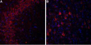 Expression of CaVα2δ3 in rat hippocampus and cortex