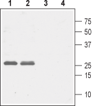 Western blot analysis of rat (lanes 1 and 3) and mouse (lanes 2 and 4) brain lysates: