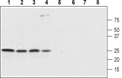 Western blot analysis of rat brain (lanes 1 and 5), rat cortex (lane 2 and 6), mouse brain (lanes 3 and 7) and SH-SY5Y (lanes 4 and 8) lysates: