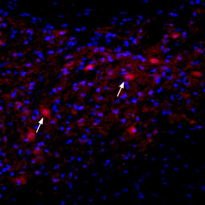 Expression of nAChRα2 in rat deep cerebellar nucleus