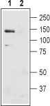 Western blot analysis of mouse liver membranes: