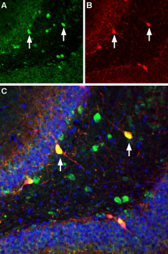 Multiplex staining of ASIC1 and parvalbumin in rat hippocampus
