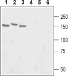 Western blot analysis of rat lung (lanes 1 and 4), rat brain (lanes 2 and 5) and hippocampus (lanes 3 and 6) lysates: