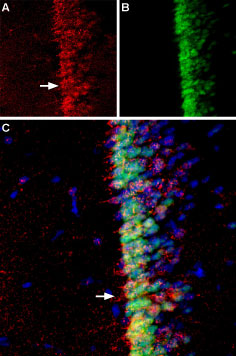 Expression of Adenylate cyclase type III in mouse hippocampal neurons