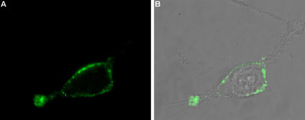Expression of Adenylate cyclase type III in rat U-87 MG cells