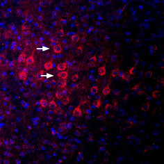 Expression of PSD-95 in mouse parietal cortex
