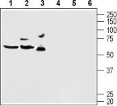 Western blot analysis of mouse brain lysate (lanes 1 and 4), rat brain lysate (lanes 2 and 5) and human U-87 MG glioblastoma cell lysate (lanes 3 and 6):