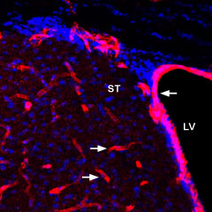 Expression of Glucose Transporter 1 in mouse striatum and wall of lateral ventricle