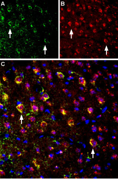 Multiplex staining of NMDAR1 and M4 muscarinic acetylcholine receptor in mouse parietal cortex