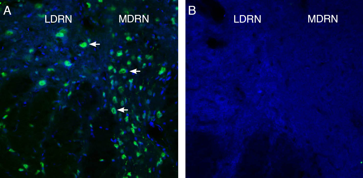 Expression of GPR4 in rat dorsal raphe nucleus (DRN). 
