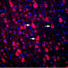 Expression of DRD1 in rat cortex