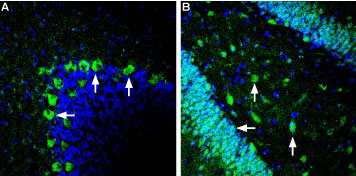 Expression of Glucose Transporter 2 in rat cerebellum and hippocampus