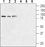 Western blot analysis of human prostate carcinoma cell lines (LNCaP (lanes 1 and 4), DU145 (lanes 2 and 5), PC-3 (lanes 3 and 6)) lysates: