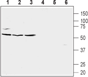 Western blot analysis of Burkitt's lymphoma (Raji) (lanes 1 and 4), human prostate carcinoma (LNCaP) (lanes 2 and 5) and human prostate carcinoma (PC-3) cell line lysates (lanes 3 and 6):