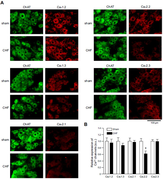 Anti-Cav2.3 (CACNA1E) Antibody