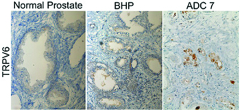 Anti-TRPV6 Antibody