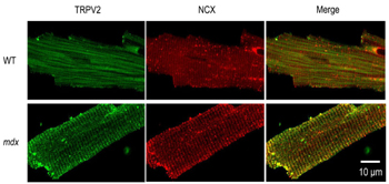 Anti-TRPV2 (VRL1) (extracellular) Antibody