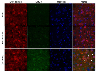 Anti-D3 Dopamine Receptor (extracellular) Antibody