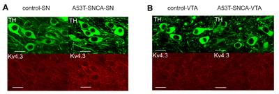 Anti-KV4.3 Antibody