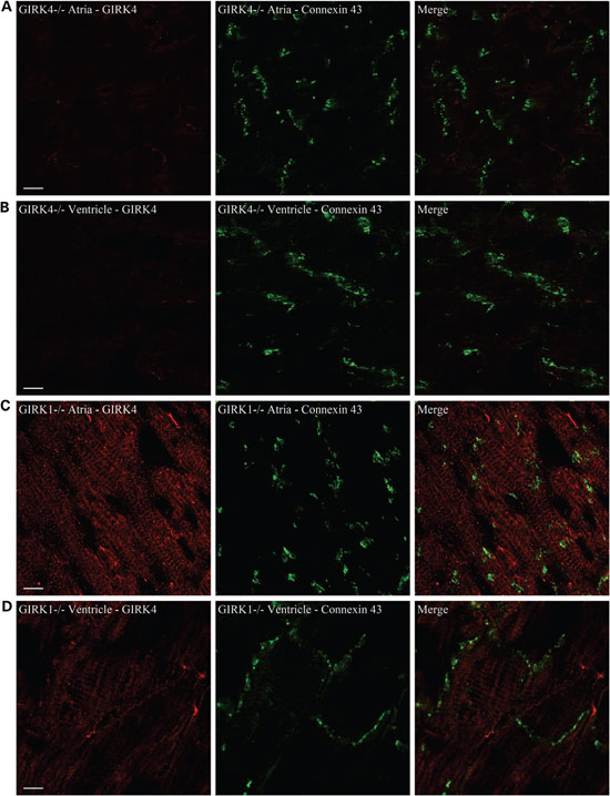 Anti-KCNJ5 (Kir3.4) Antibody