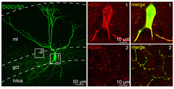 Anti-HCN1 Antibody