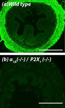 Anti-P2X1 Receptor Antibody