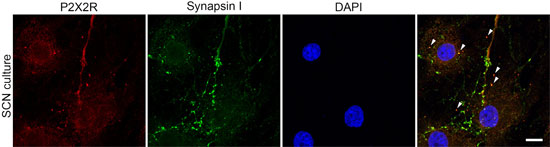 Anti-P2X2 Receptor Antibody