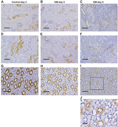 Anti-Aquaporin 2 Antibody