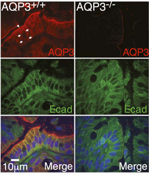 Anti-Aquaporin 3 Antibody