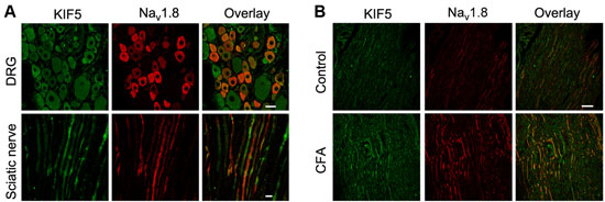 Anti-Nav1.8 (SCN10A) Antibody