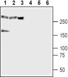 Western blot analysis of mouse brain (lanes 1 and 4), rat brain (lanes 2 and 5) and human brain neuroblastoma cells (SH-SY5Y) (lanes 3 and 6):